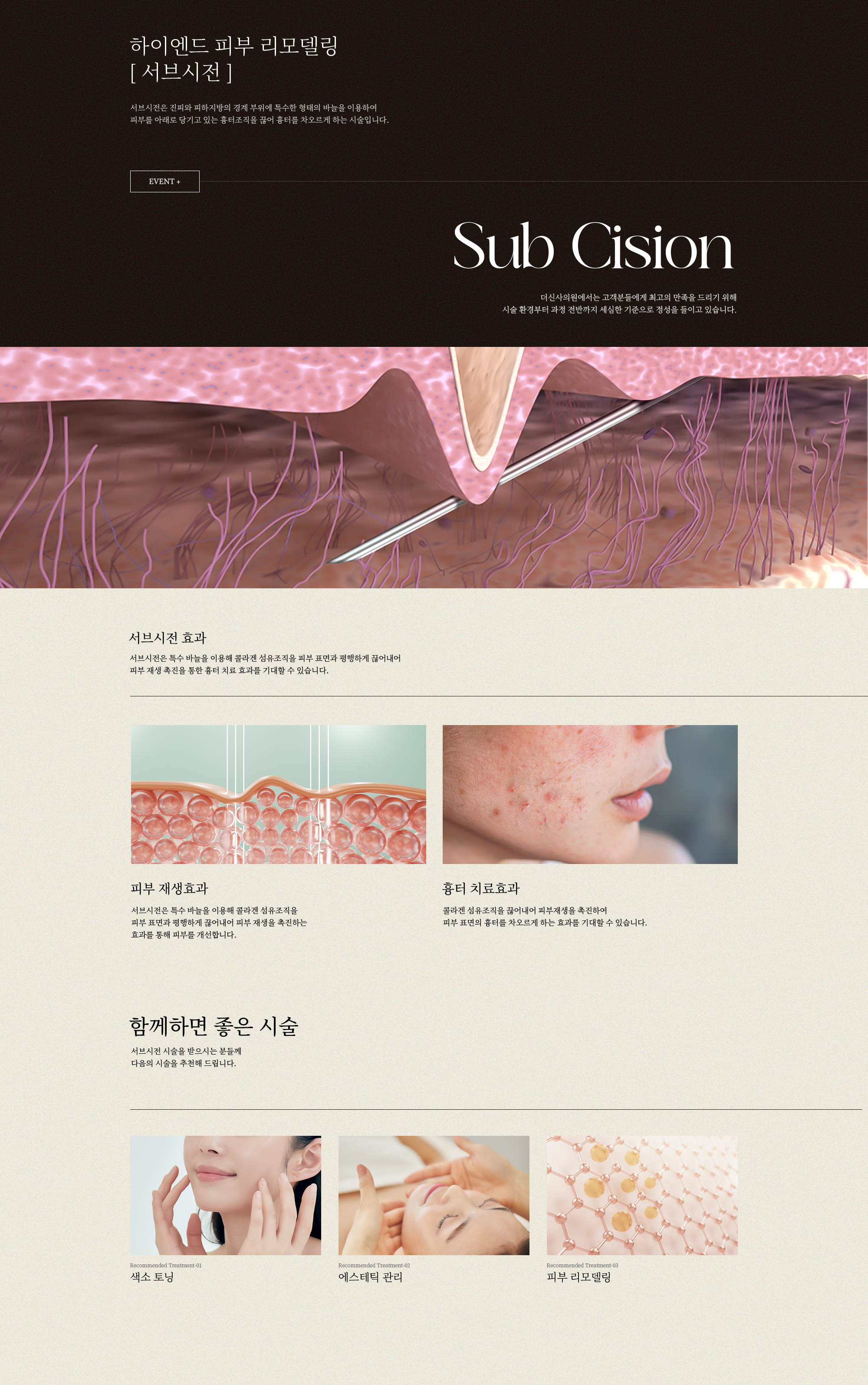 서브시전